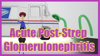 Acute PostStreptococcal Glomerulonephritis Mnemonic for the USMLE [upl. by Rosio43]