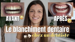 BLANCHIMENT DENTAIRE chez le dentiste prix durée sensibilité [upl. by Tneicniv]