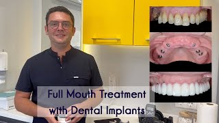 All on 6 Implant Treatment in Turkey amp Full Mouth Dental Implants by Elit Dental Clinic Kusadasi [upl. by Edita249]