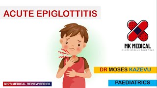 Acute Epiglottitis [upl. by Fadiman541]