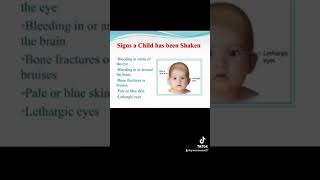 ShakenBaby Syndrome Educational Video [upl. by Maurey192]