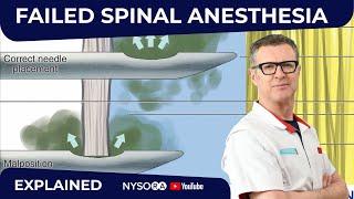 Failed Spinal Anesthesia Explained 1  Regional anesthesia Crash course with Dr Hadzic [upl. by Ylil]