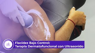 Flacidez Bajo Control Terapia Dermatofuncional con Ultrasonido [upl. by Valoniah665]