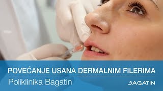 Povećanje usana dermalnim filerima [upl. by Tehr]