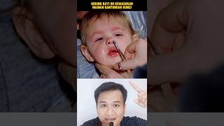 HIDUNG BAYI INI KEMASUKAN MAINAN‼️shorts alurcerita storytelling [upl. by Bastian]