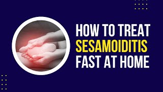 Sesamoiditis Treatment What Can I Do at Home [upl. by Ettennaj]