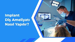 Implant Diş Ameliyatı Nasıl Yapılır [upl. by Ahsinert598]