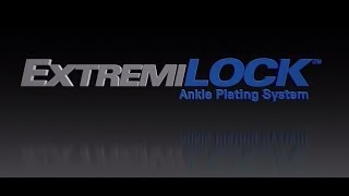 OsteoMed  ExtremiLOCK Ankle Plating System  Ankle Fracture Plating [upl. by Radu]