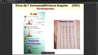 Virologie  VIH FMPC [upl. by Burrus]