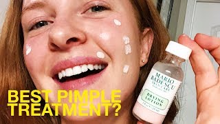 Best Pimple Spot Treatment I Try Mario Badescu Drying Lotion [upl. by Anelet64]