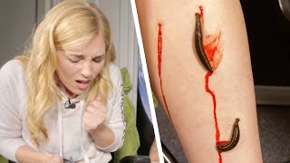 Leeches Suck Maddie’s Blood TimeLapse  Earth Unplugged [upl. by Cooley]