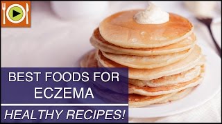 Best Foods for Eczema  Healthy Recipes [upl. by Miof Mela]