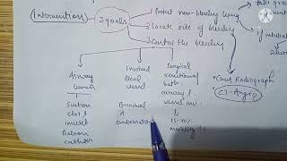 Management of hemoptysis [upl. by Gudren]