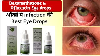 ofloxacin dexamethasone eye drops use dosage side effects in hindi  OFC DX eye drops in hindi [upl. by Allen234]