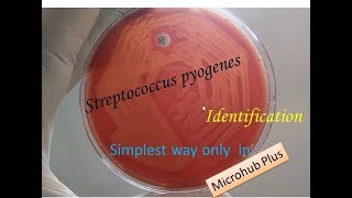 Streptococcus pyogenes identification [upl. by Kallista708]