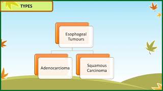 Esophageal Carcinoma  Adenocarcinoma [upl. by Ahgem768]