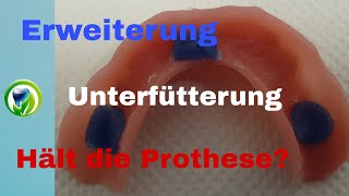 Erweiterung und Unterfütterung einer Unterkiefer Totalprothese  Saugt die Prothese immer [upl. by Vashtia]