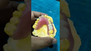 Upper Flexible Partial Denture By Haider 😁😁😁flexible partialdenture [upl. by Euqinorev424]