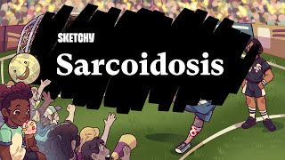 Understanding Sarcoidosis Causes Symptoms amp Treatment Part 1  Sketchy Medical  USMLE Step 2 CK [upl. by Adnarrim]