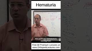 Hematuria shortvideo shorts drnajeeb drnajeeblectures [upl. by Rasmussen]