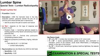 Straight Leg Raise Test  Rationale amp Interpretation [upl. by Cohn935]