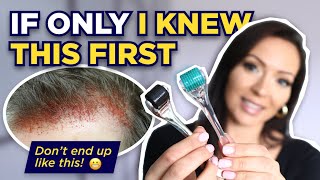 The Dermaroller Watch This BEFORE Microneedling What I wish I knew Before I Started Dermarolling [upl. by Latsyrk]