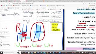 UPPER LIMB FRACTURES  ORTHOPEDICS  5TH YEAR [upl. by Uri]