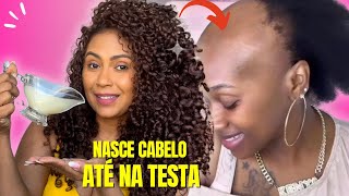 O cabelo cresce loucamente e não cai 3 ingredientes poderosos para o crescimento EXTREMO do cabelo [upl. by Haraf]