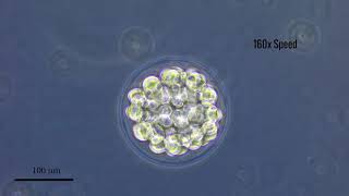 Fertilization amp Early Development of Lytechinus variegatus [upl. by Annauqal]