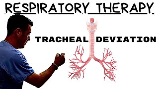 Respiratory Therapist  Tracheal Deviation [upl. by Catina]