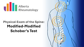 Rheumatology BACK exam Schobers Test [upl. by Amlet]