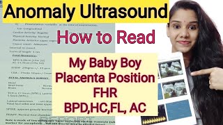 Anomaly Scan 20 weeks घर पर कैसे पड़े ।Anomaly Scan Baby Boy or Baby Girl How to Read level 2 report [upl. by Aryk]