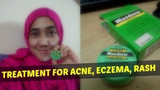 How to Cure Acne and Scar Fast [upl. by Ahsienar94]