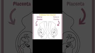 Why Your Placenta Location Matters [upl. by Cacka]