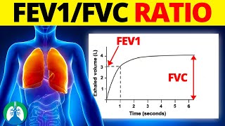 FEV1FVC Ratio Medical Definition  Quick Explainer Video [upl. by Bord]