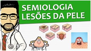 Semiologia 10  Lesões elementares da pele Vídeo Aula [upl. by Lach986]