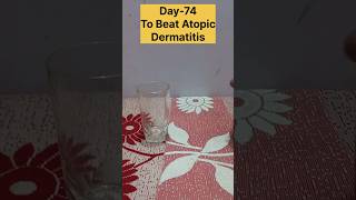 Day74 To Beat Atopic Dermatitis✅️ [upl. by Ehsrop]