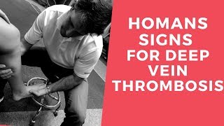 Homans Sign for Deep Vein Thrombosis [upl. by Hanselka630]