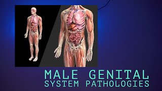 TESTICULAR NEOPLASMS seminomas and nonseminomas lecture 5 of Male genital system pathology [upl. by Martineau]