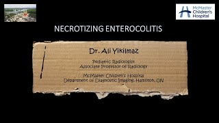 Necrotizing Enterocolitis [upl. by Adnohsirk798]