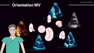 〖Echocardiography〗 All about the mitral valve  Barlows prolapse amp flail leaflet 💖 [upl. by Ilehs]