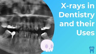 Types of Dental Xrays you NEED to know  Dental Radiographs and Why we use them [upl. by Siddon]