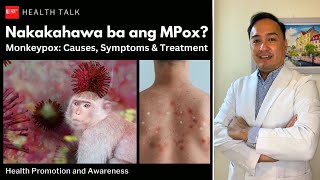 Nakakahawa ba ng Mpox Monkeypox Causes risk factors symptoms treatment and prevention [upl. by Anelhtac]