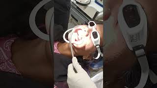 Surgical excision of fibroma from maxillary gingiva with laser [upl. by Dalt]