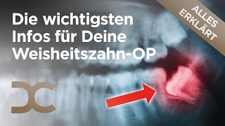 Weisheitszähne entfernen Alles zur schonenden WeisheitszahnOP in Dämmerschlaf  Dorow Clinic [upl. by Aikemit93]