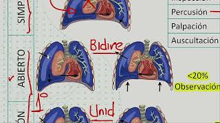 Cardiología  Trauma toracico hemotorax neumotorax torax inestable [upl. by Nidia]