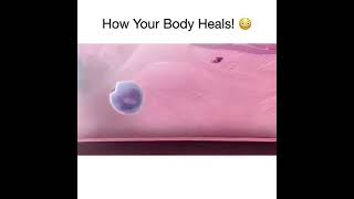 How Body Heals Wounds [upl. by Otrebmuh]