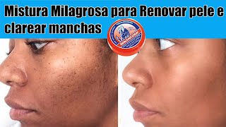 MISTURA MILAGROSA PARA RENOVAR PELE E CLAREAR MANCHAS [upl. by Yenitsed842]