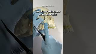 💀 How To Break The Tuberosity  OnlineExodontiacom  dentaltips dentist [upl. by Theall]