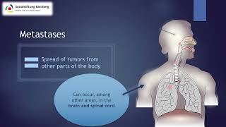 Briefly explained Metastases [upl. by Rutger]